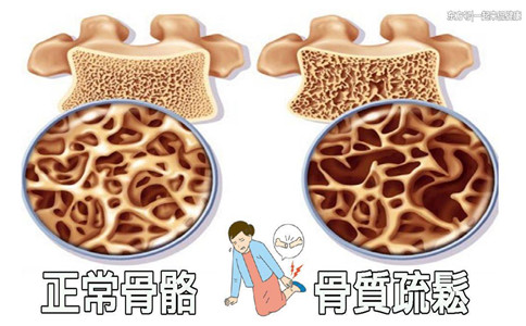進(jìn)口骨密度儀廠家